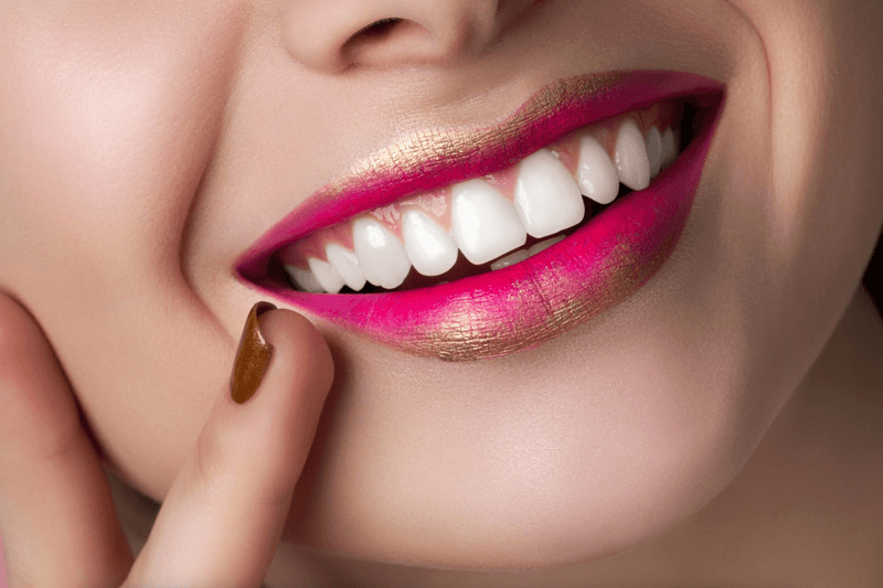 Hollywood Smile