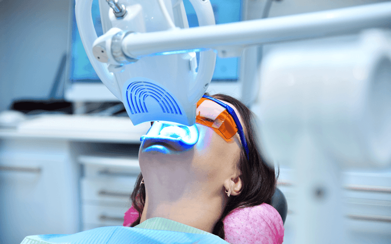 In-Clinic and Home Bleaching