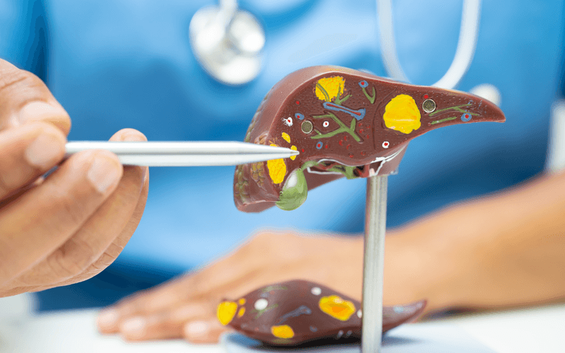 Liver Conditions