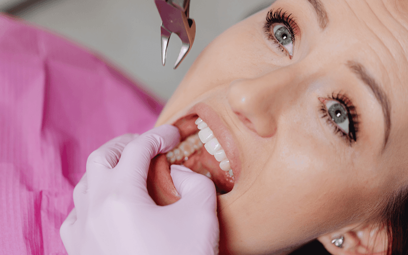 Simple Extraction