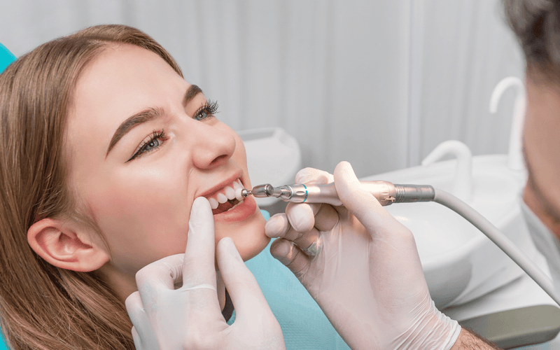 Teeth Cleaning (Scaling)